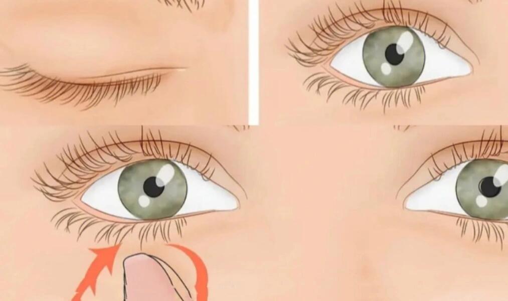 疾病记录:下眼睑脉搏式跳动 病由:前段时间,不停专注看东西,很少休息