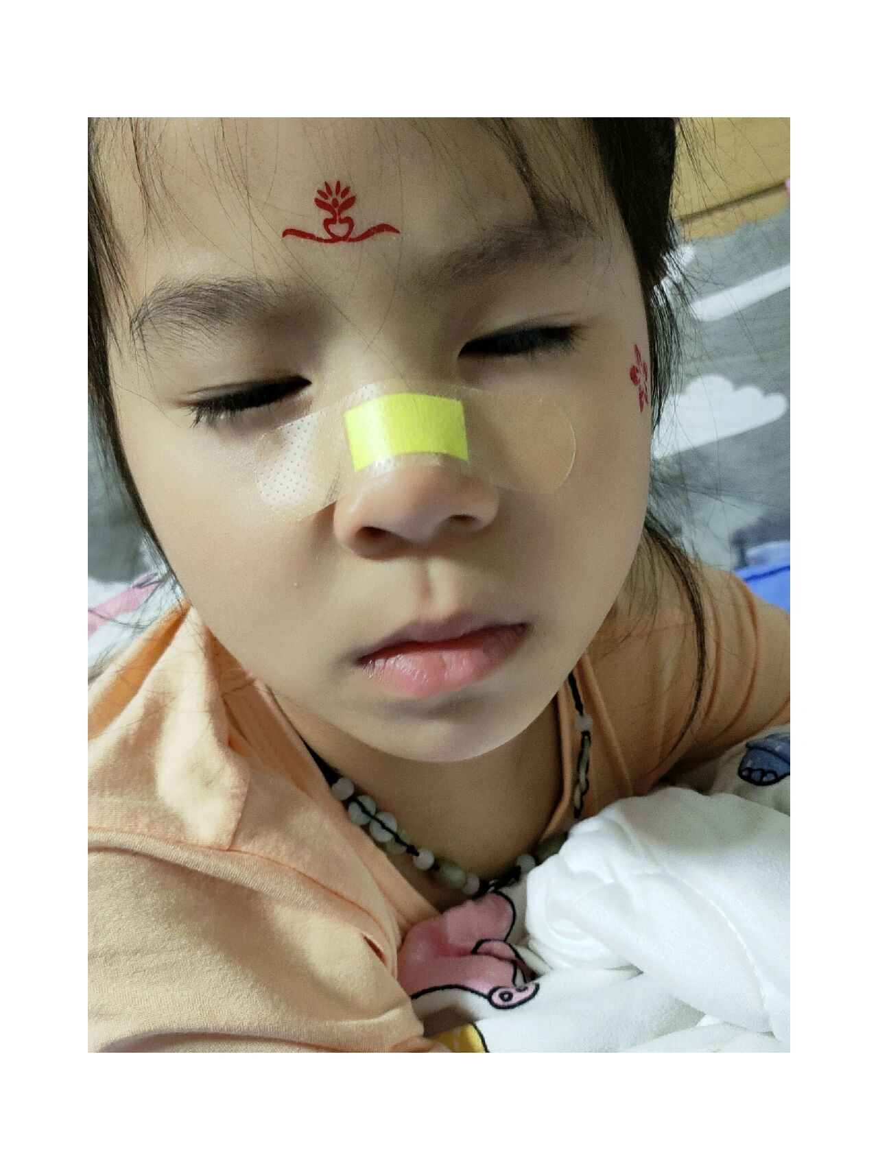 在家自己做的简易版鼻👃🏻通贴 宝宝鼻塞难受睡不好,宝妈们快看