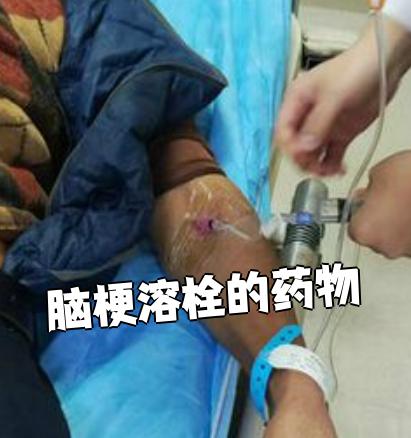 脑梗溶栓常用的药物包括尿激酶,阿替普酶和替奈普酶