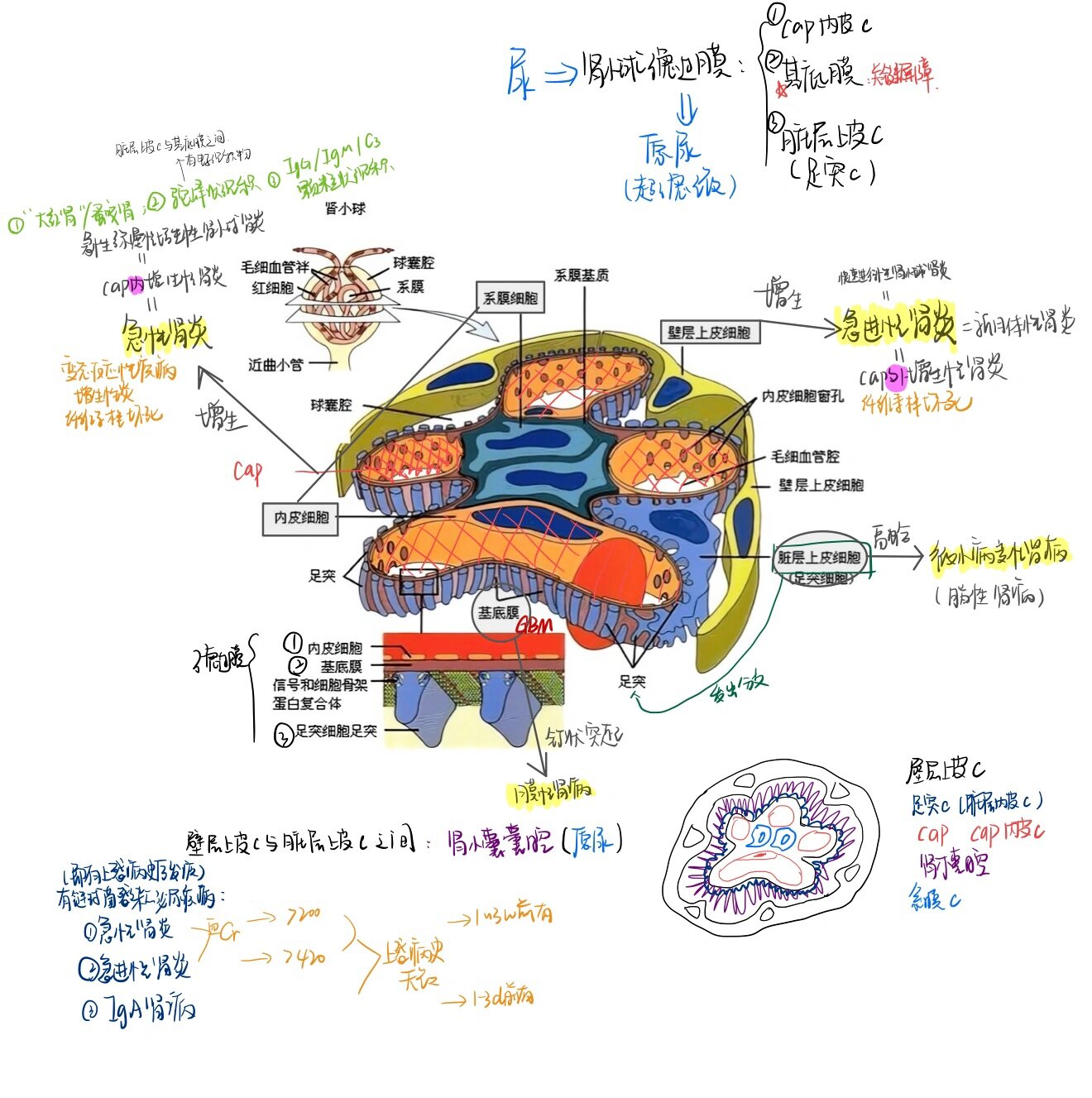 24医学考研—肾小球,泌尿疾病相关手绘