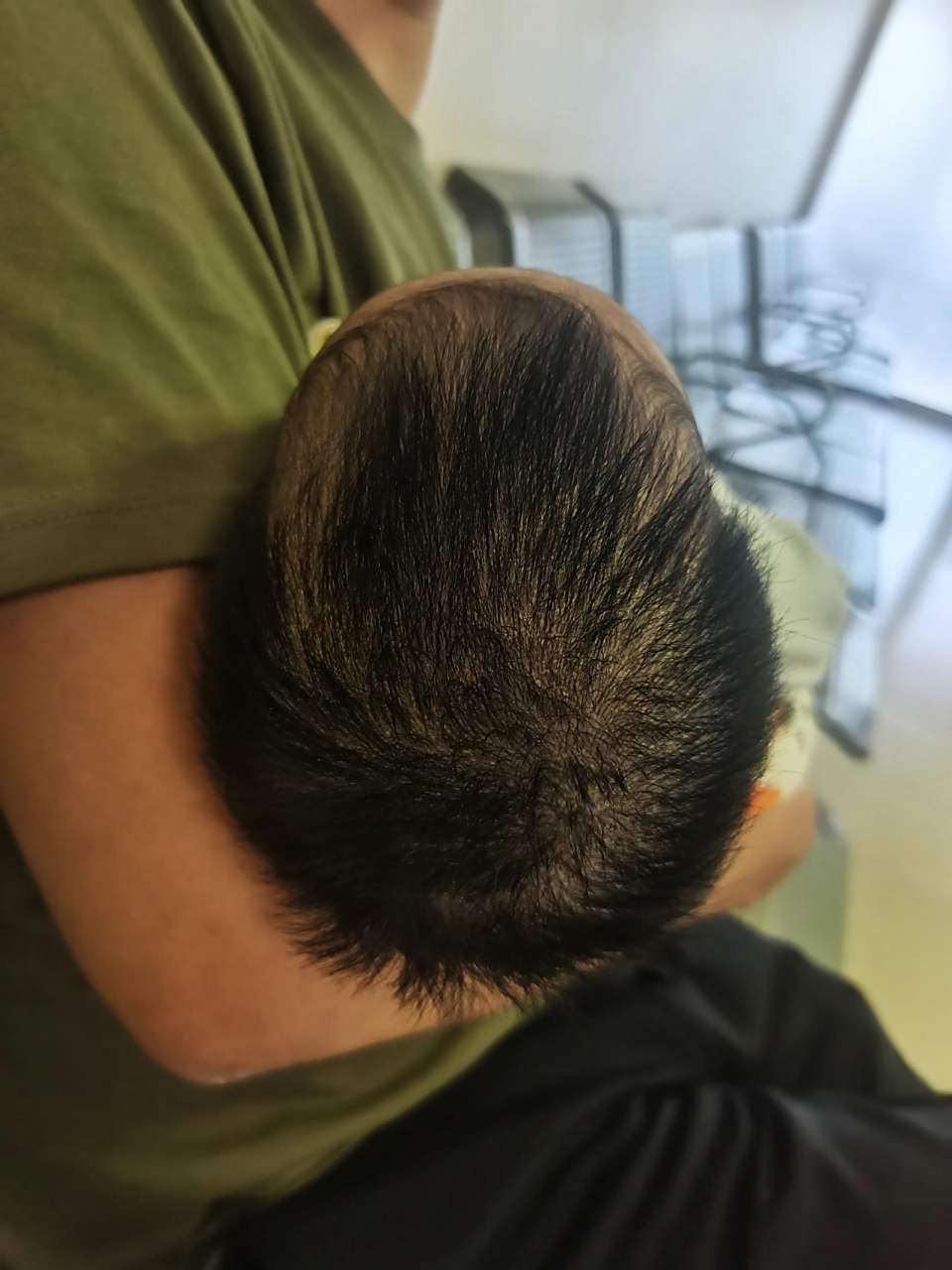 月子里防吐奶一般都左右侧睡,出了月子变成从顶上看长长的,脑袋尖尖的