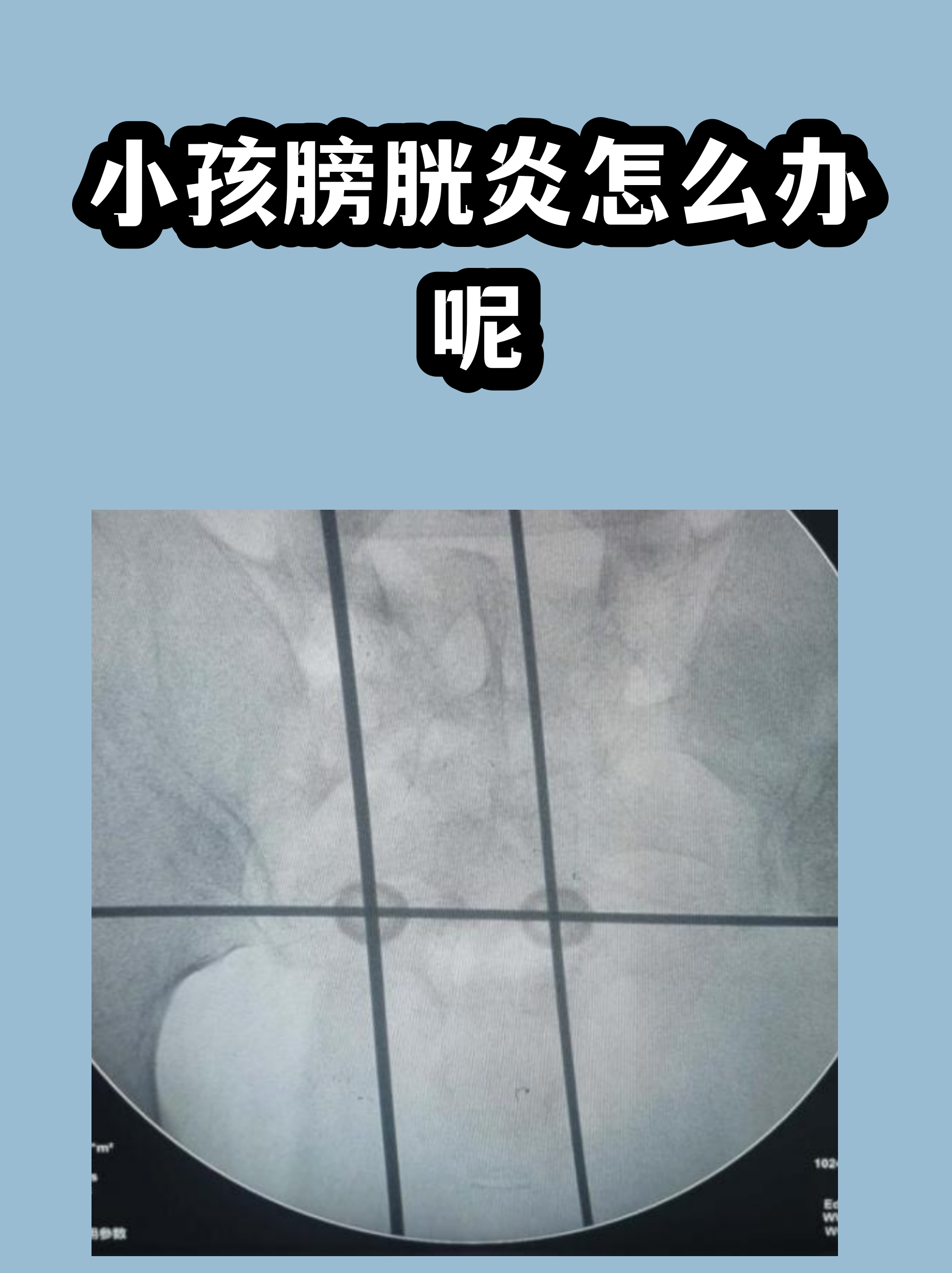 关于原空军总医院检查陪护加挂号及时解决你就医问题的信息 关于原空军总医院检查陪护加挂号及时解决你就医问题的信息