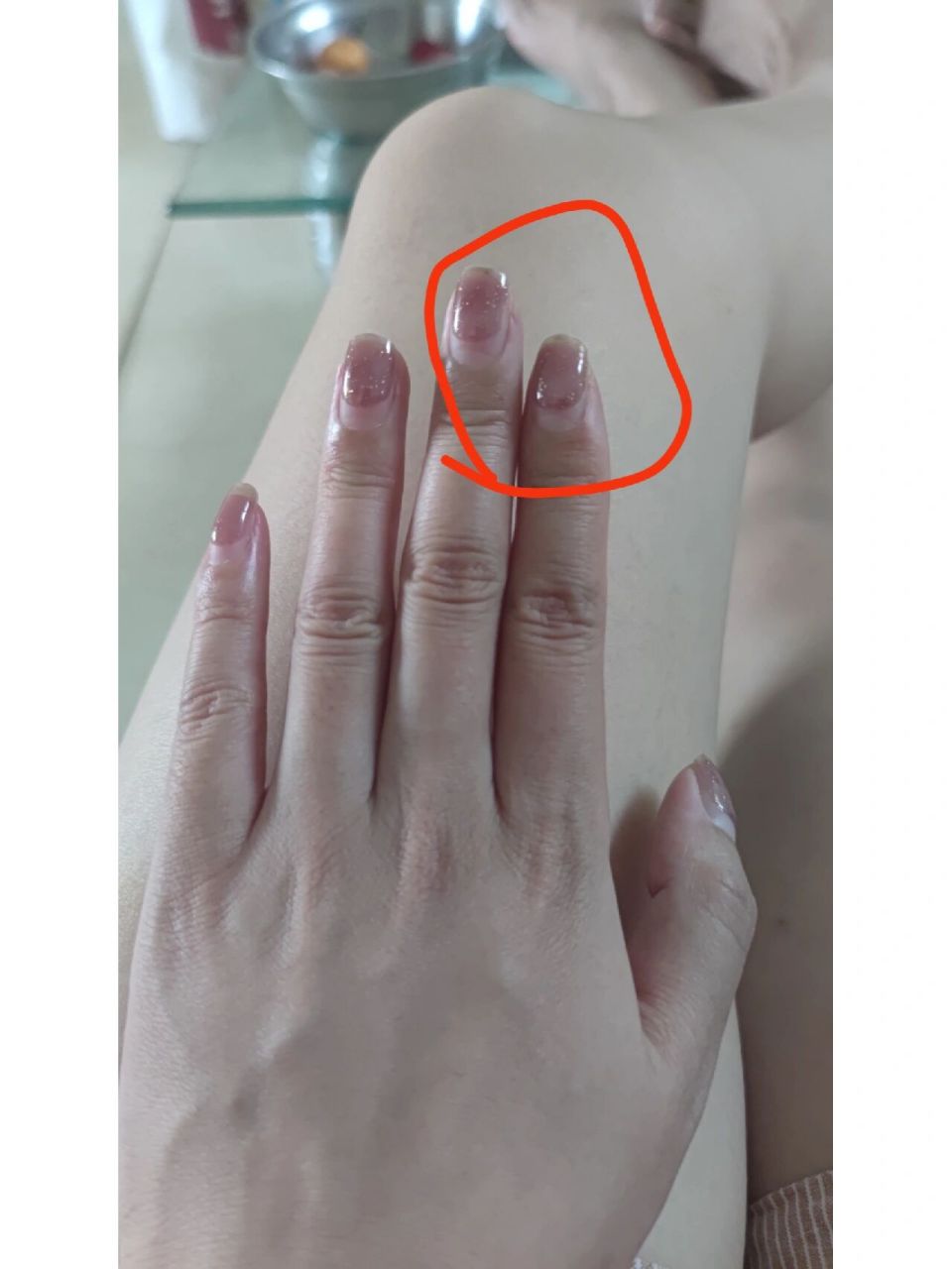 手指头疼是咋回事