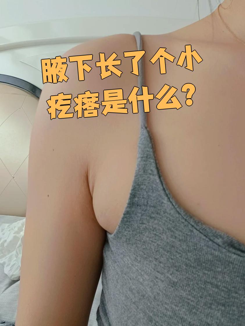 腋下突然冒出个小疙瘩,可能是湿疹,毛囊炎或软纤维瘤引起的