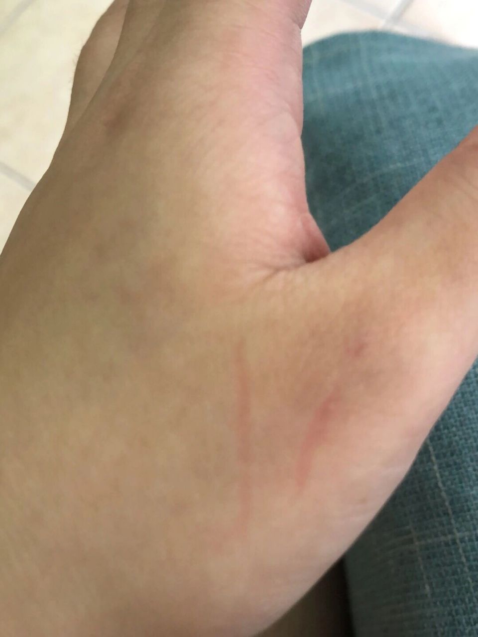 宠物狗抓红 请问被自家狗抓红了,但是没破皮,没留血,需要打针91吗?