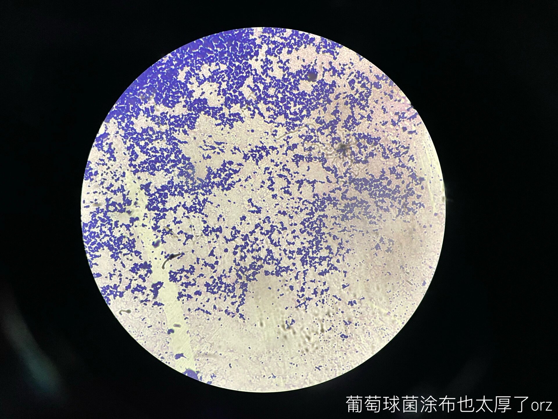 生日常|把大肠杆菌染成革兰阳性了