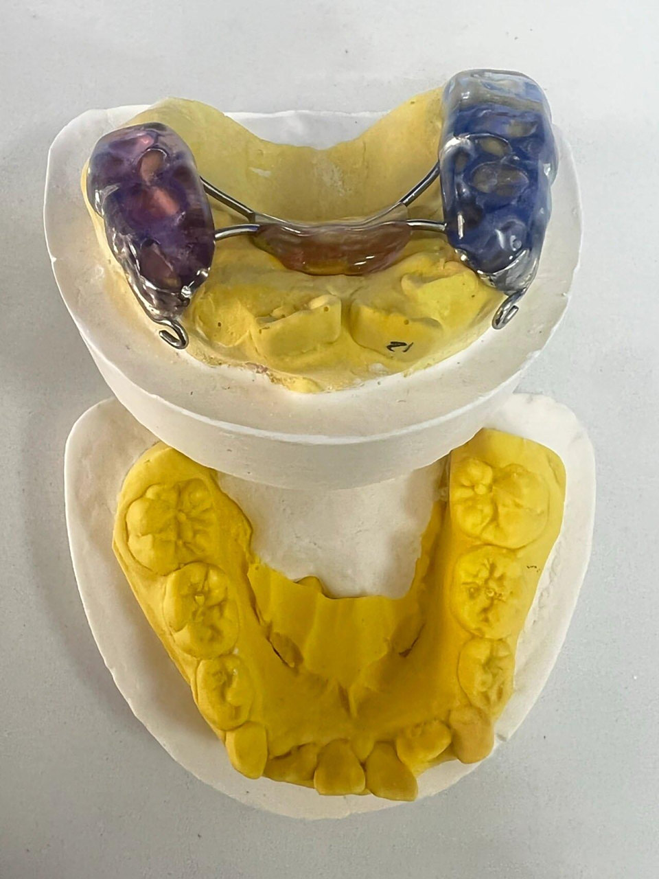 "地包天"前方牵引佩戴注意事项7515 1.