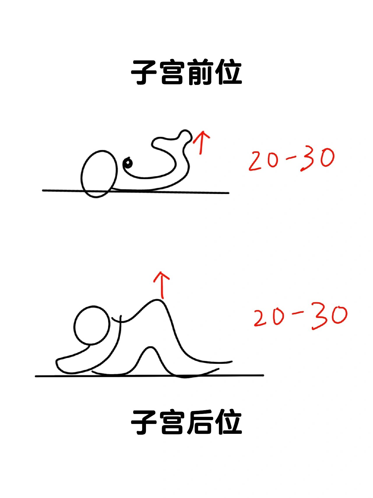 安排后-子宫前后位对应姿势