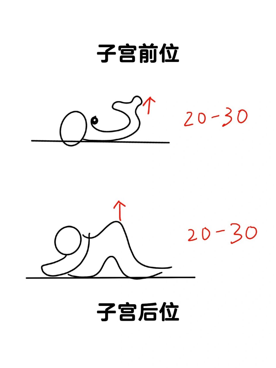 安排后-子宫前后位对应姿势 本人大姨妈比较正常,但是备孕小半年了无