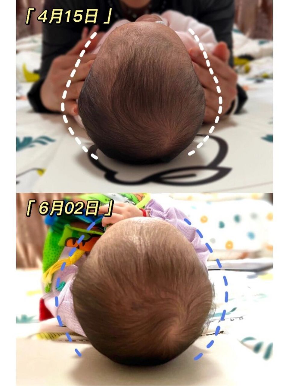 婴儿菱形头型图片图片