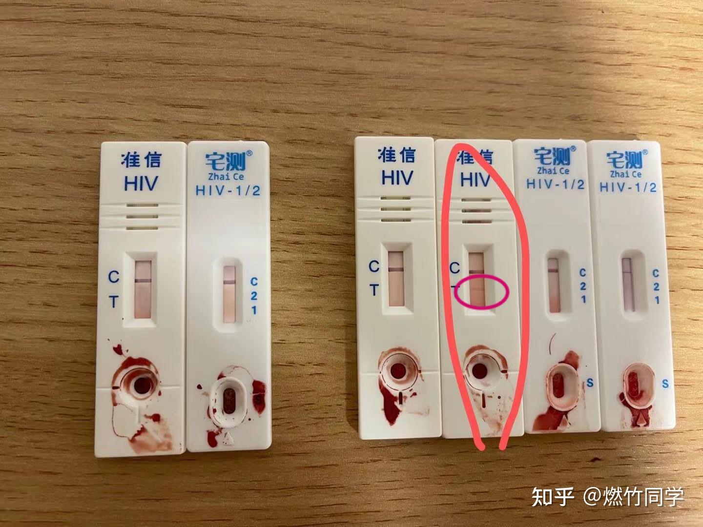 hiv试纸结果怎么看图解图片