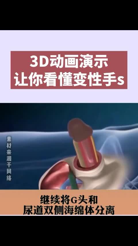 变性手术3d动画演示