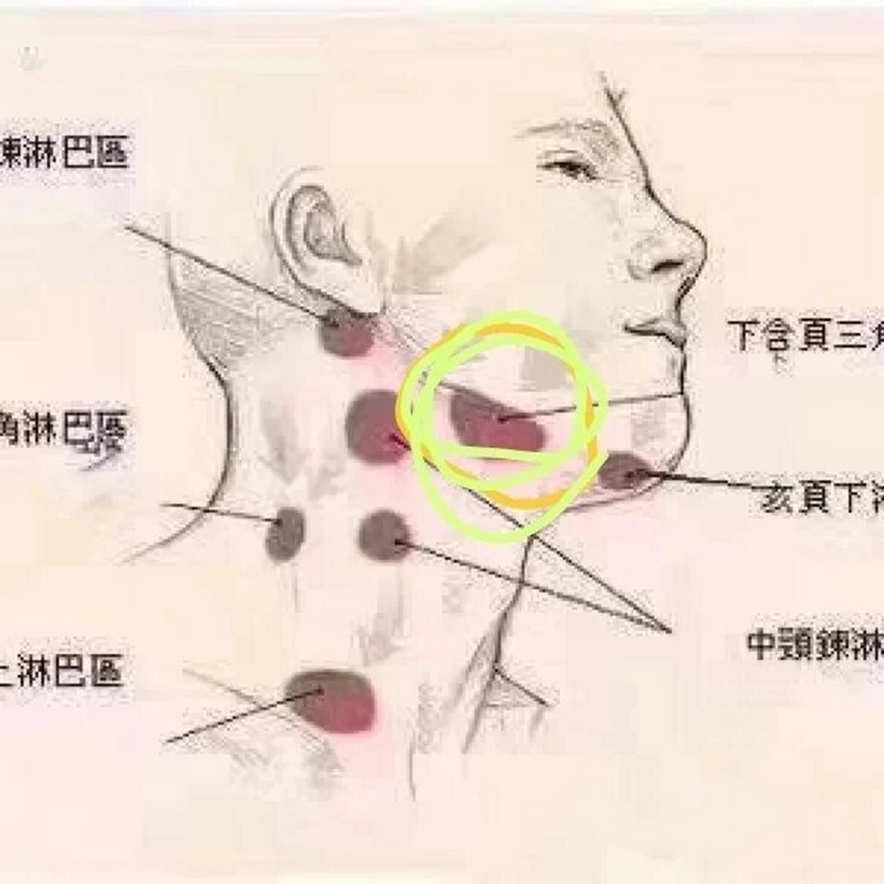 下颌骨致密性骨炎图片图片