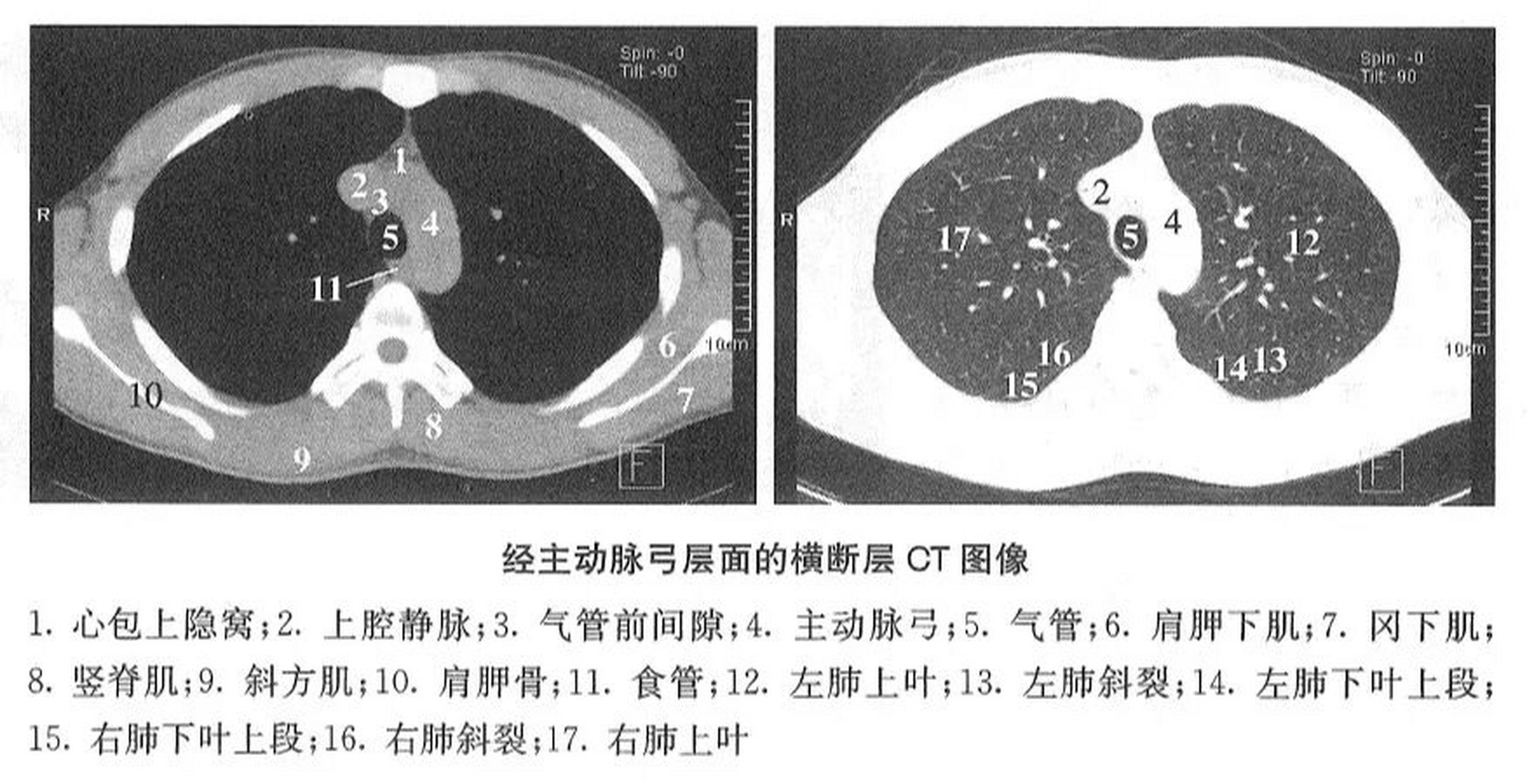 心脏ct断层解剖图中文图片