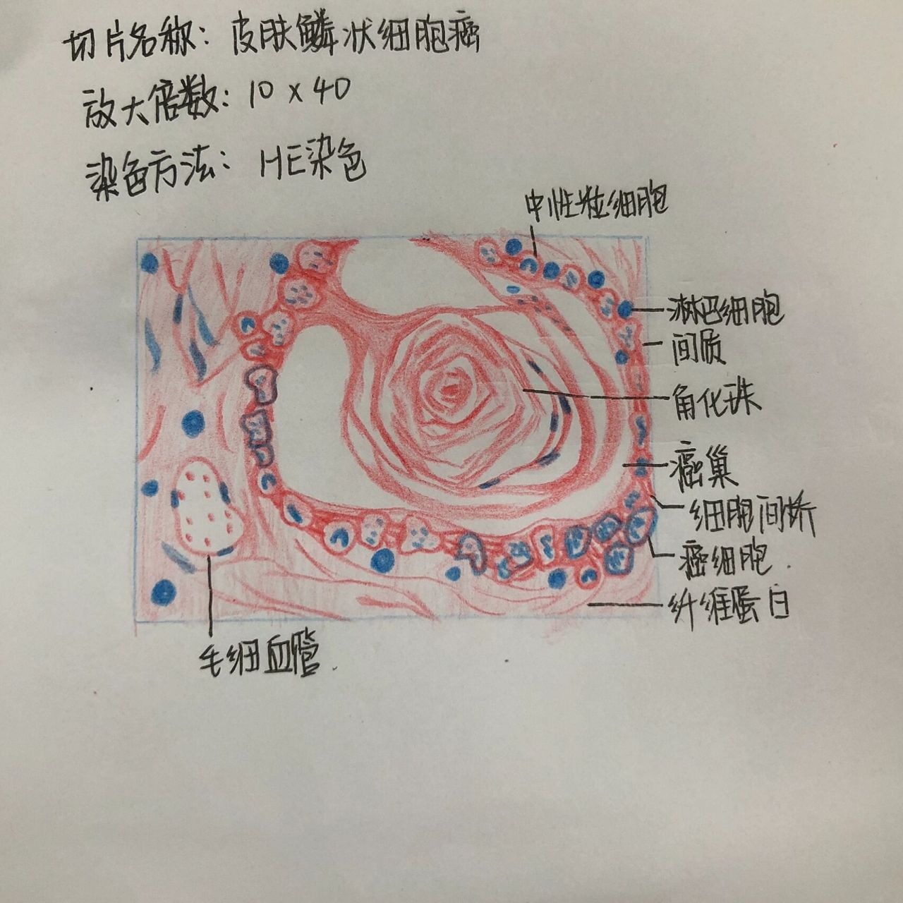 绒癌红蓝铅笔图图片