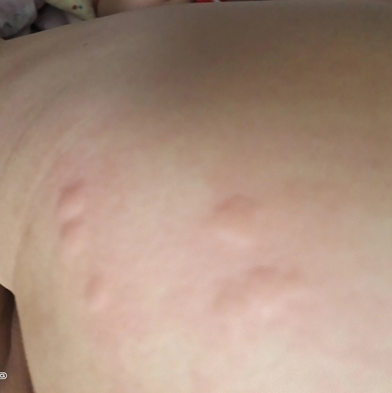 新房入住后家里突然发现蚂蚁,咬人!