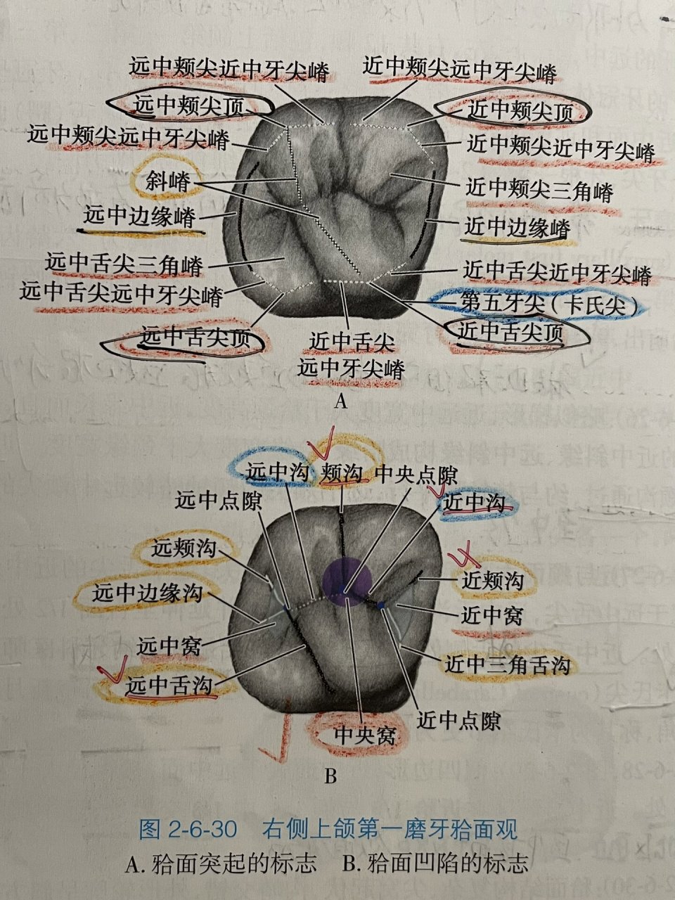 右上第一磨牙合面解剖标志图