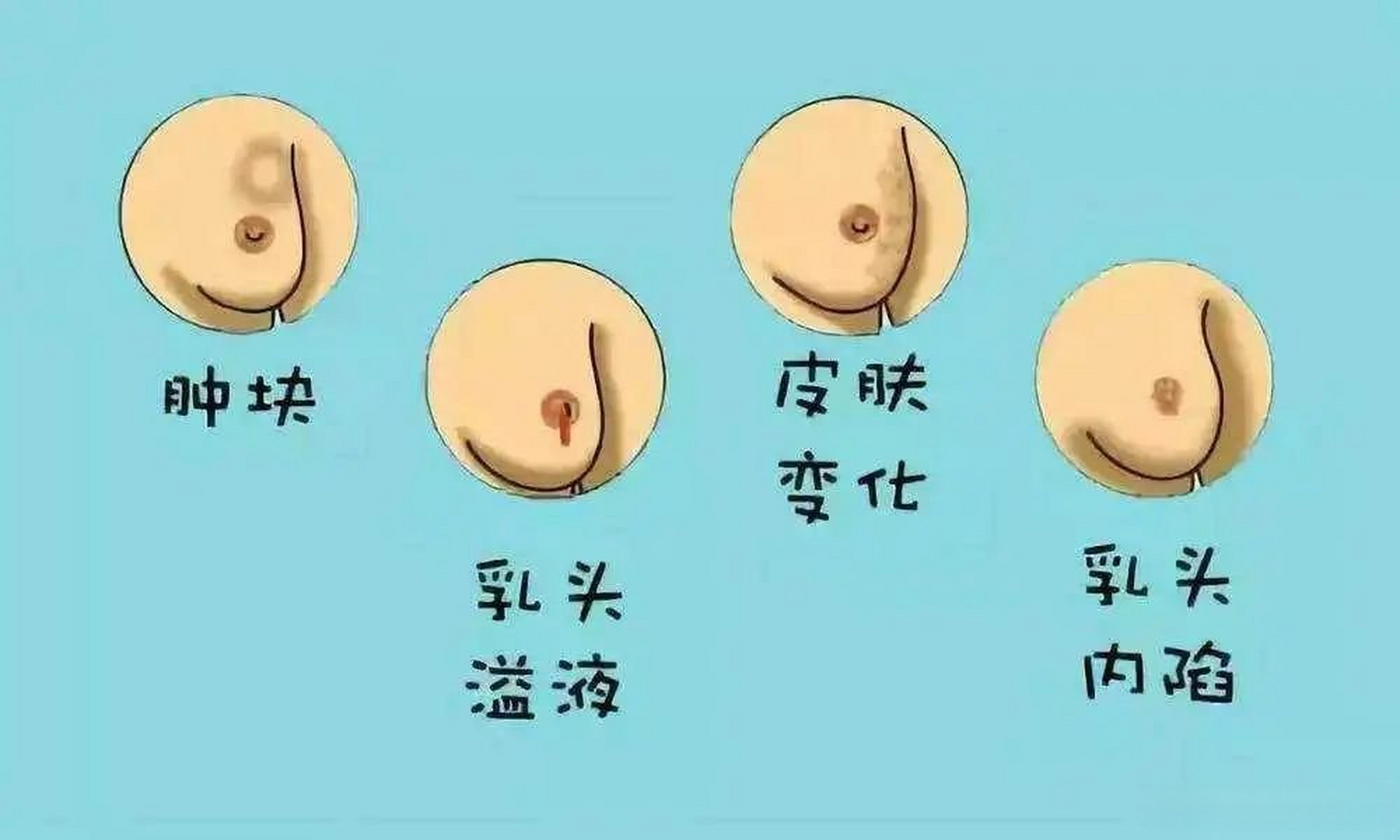 乳头疼怎么回事女性图片