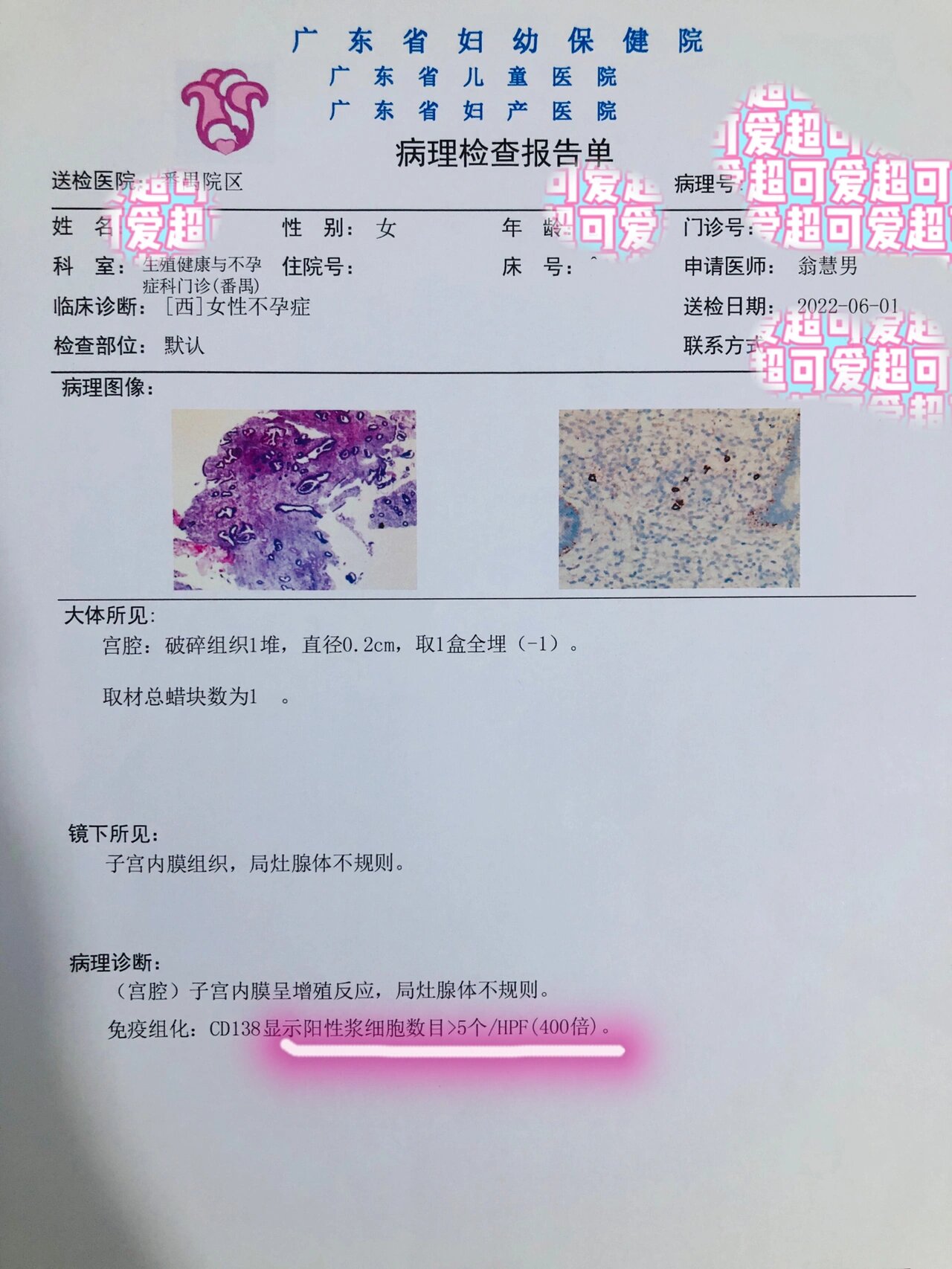 内膜骚刮(子宫内膜炎复查) 继14天药后的子宫内膜炎复查 💰费用大概