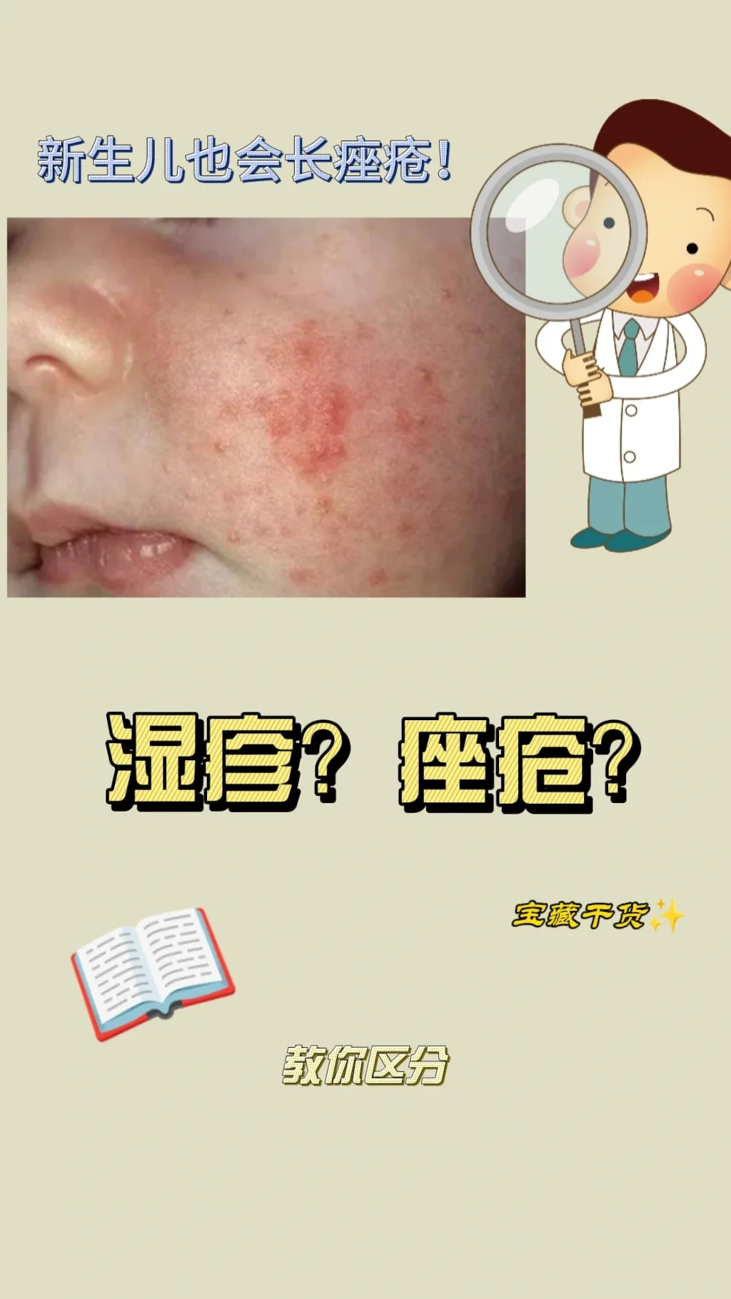 新手爸妈必看!教你区分新生儿痤疮和湿疹