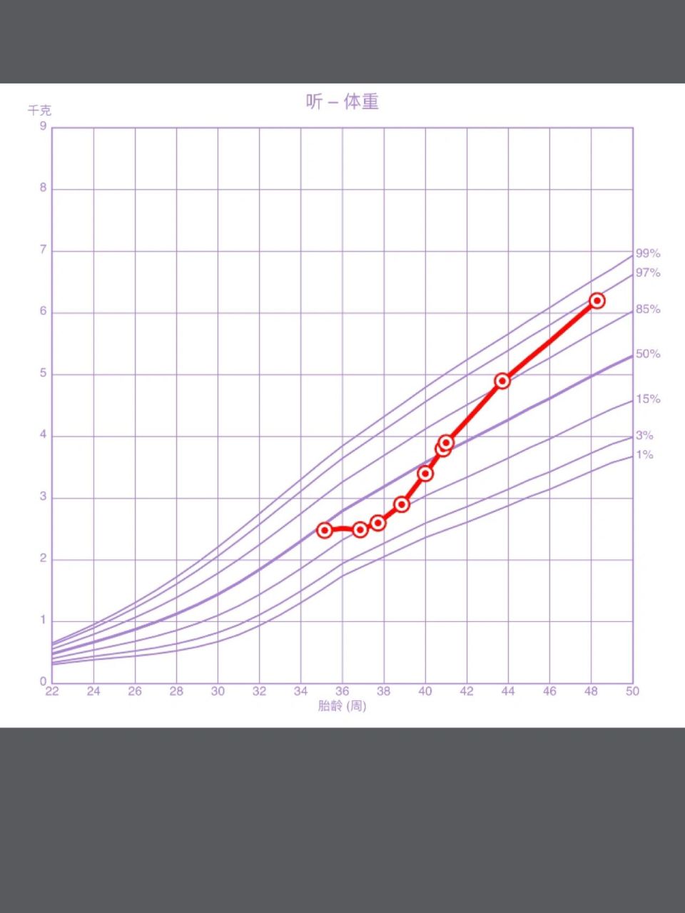 35 1早产儿前三个月生长发育曲线分享94 小听三个月啦 35 1早产