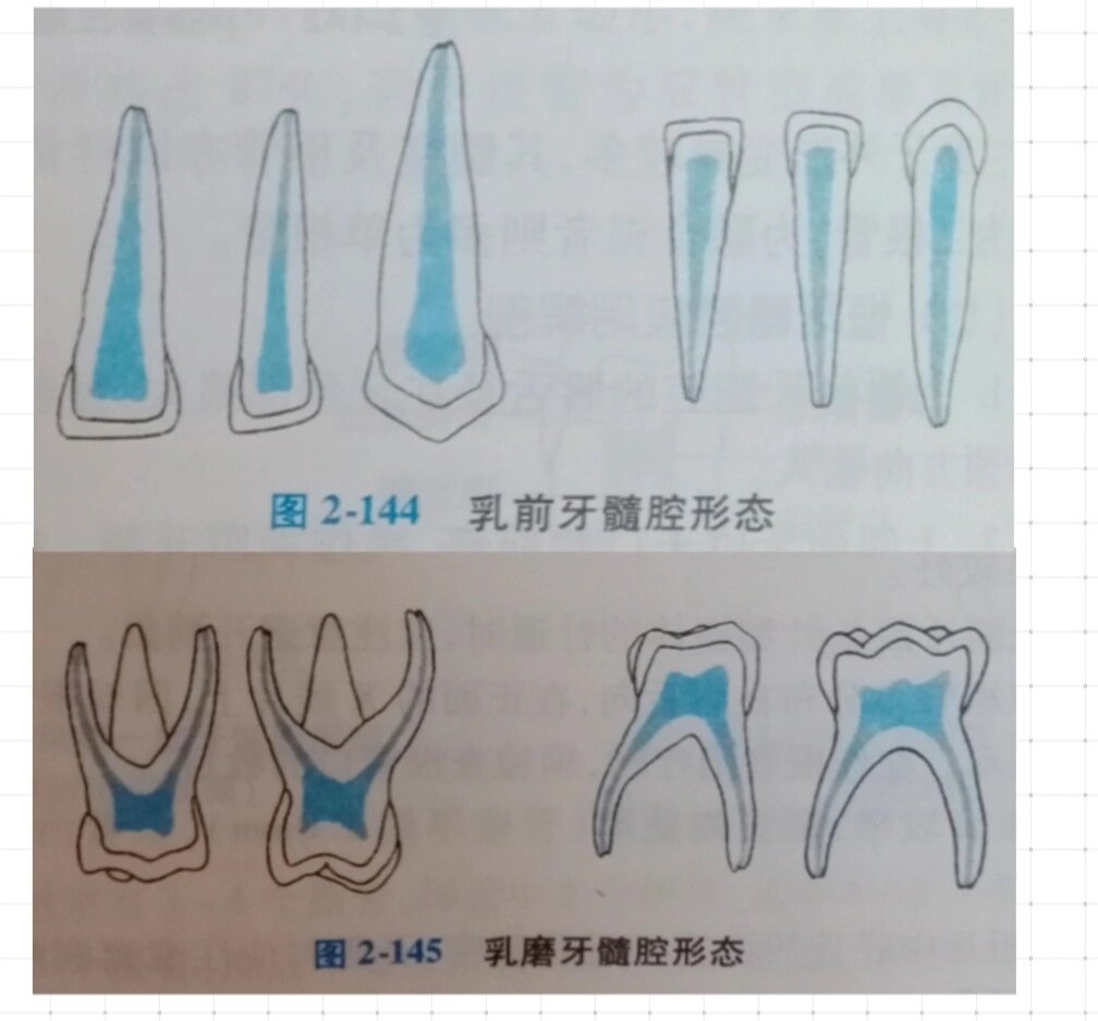 乳牙髓腔形态