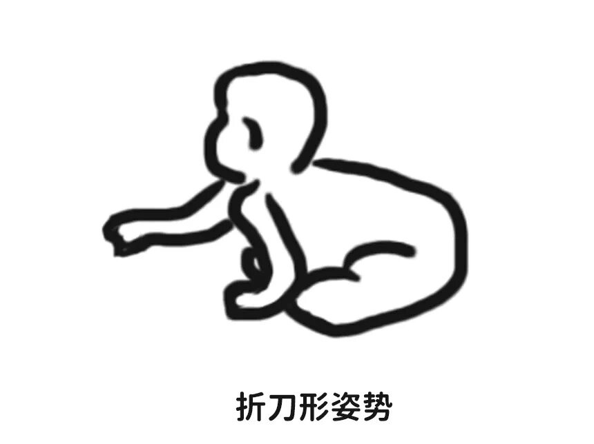 宝宝有这些症状,预示着肌张力低!