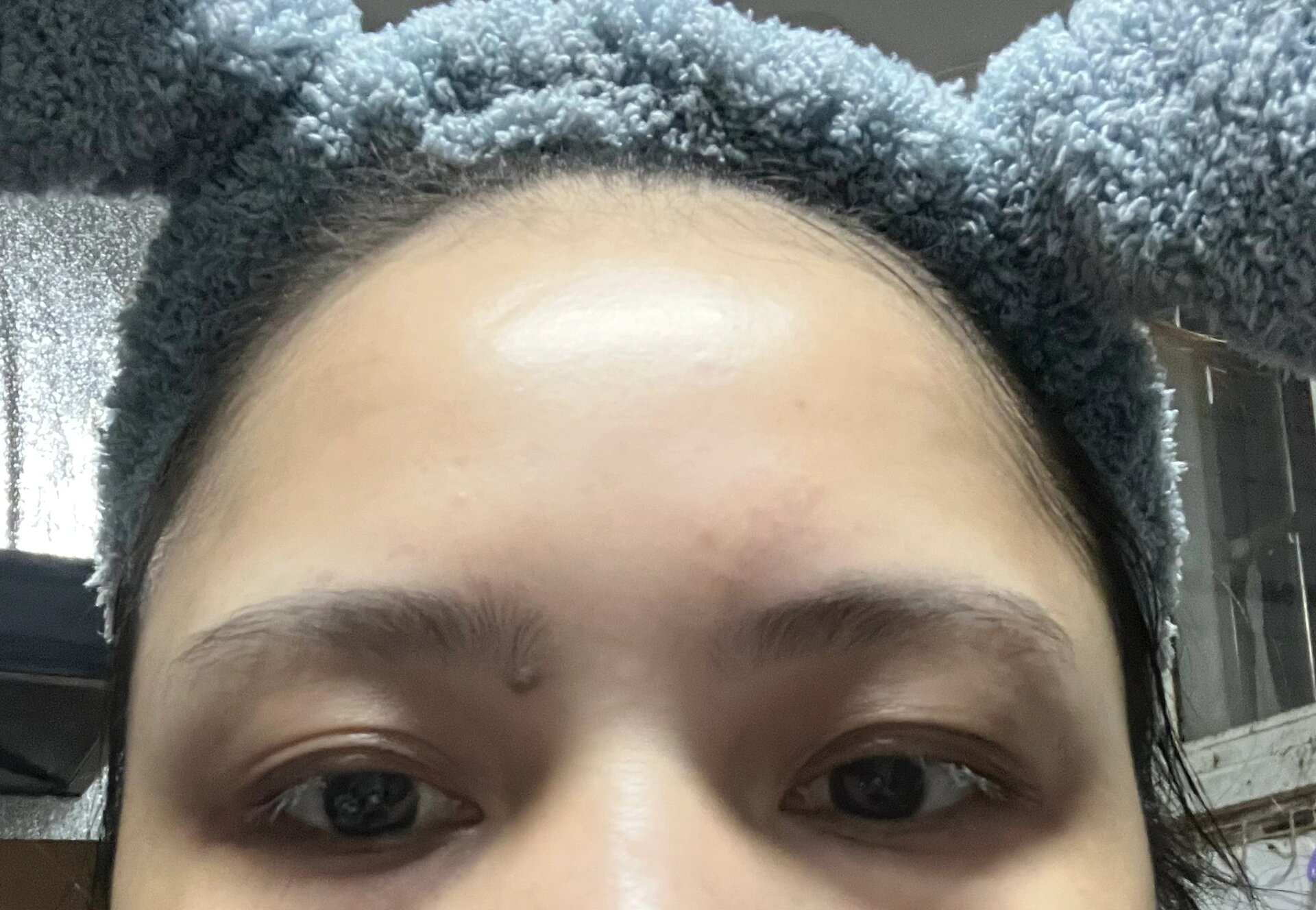 右眉毛的痣