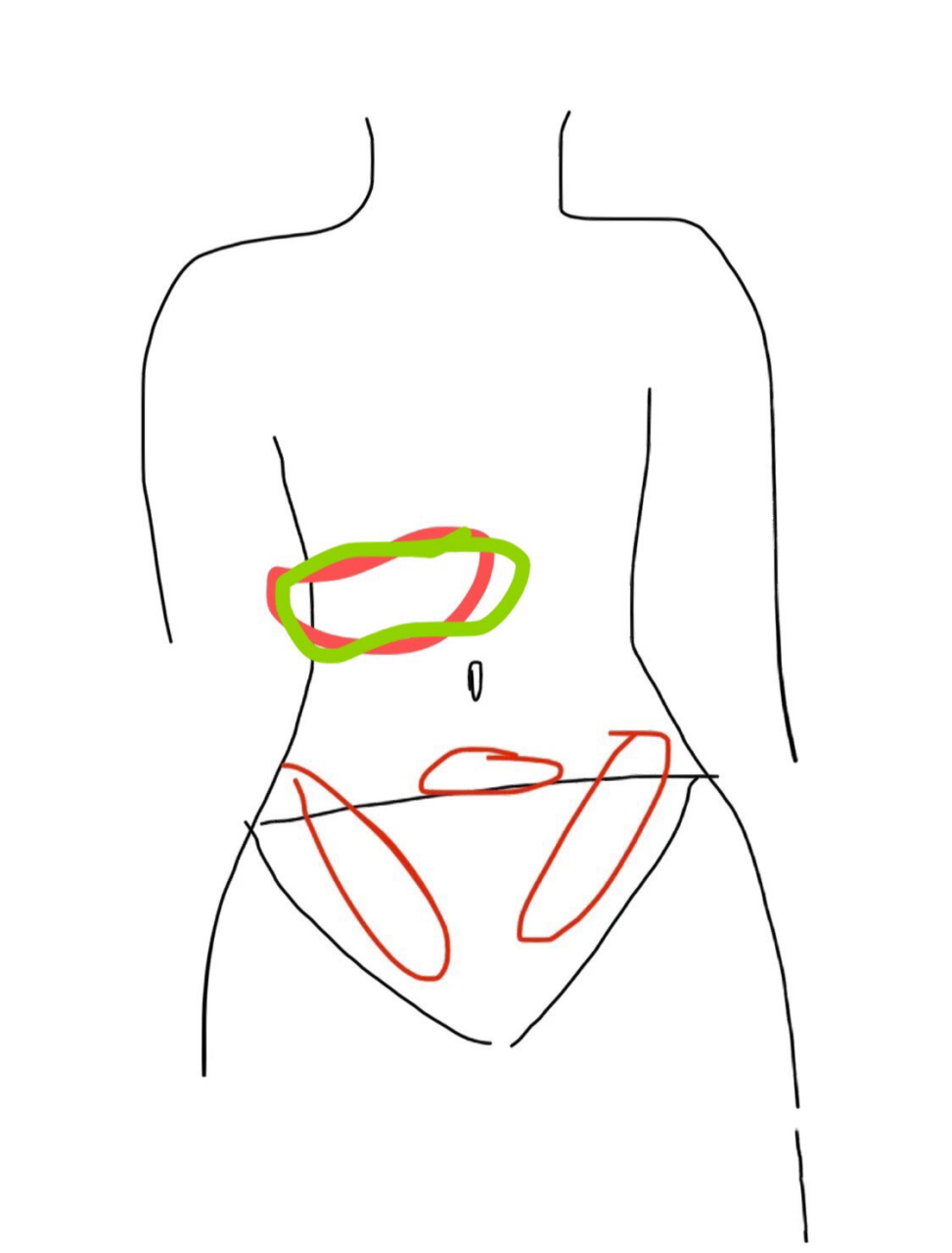 孕16周,肚脐上面痛 晚上突然图片,绿色那个位置痛.