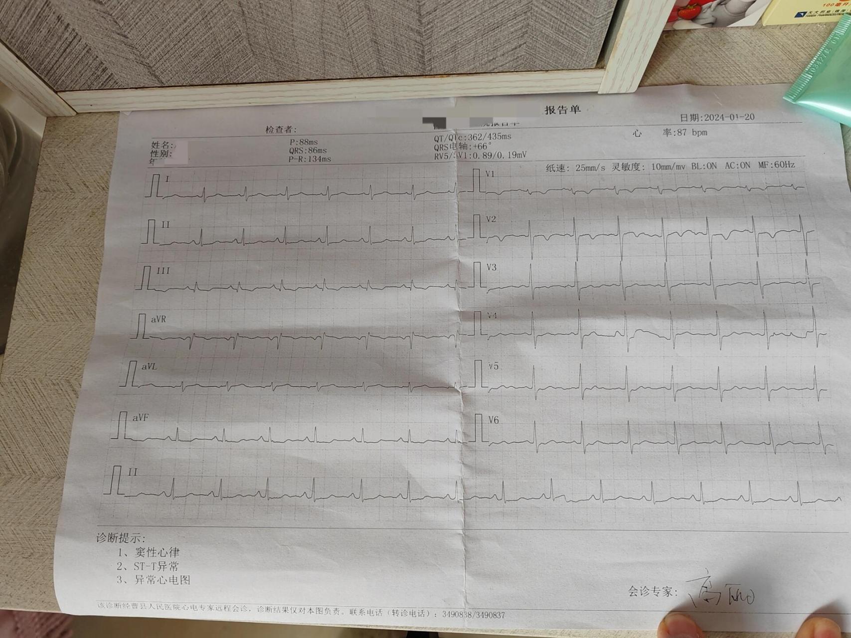 心电图显示窦性心律 st