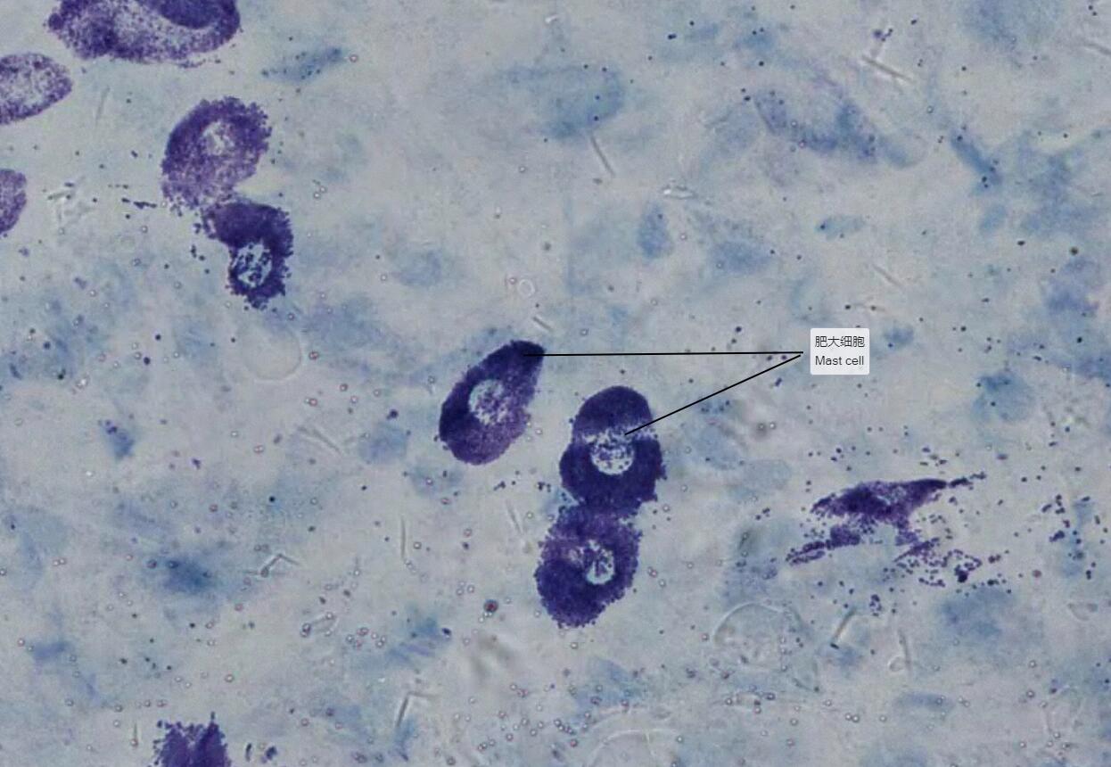3 结缔组织:肥大细胞(组织学与胚胎学) 异染性 名称:肥大细胞(肠系膜