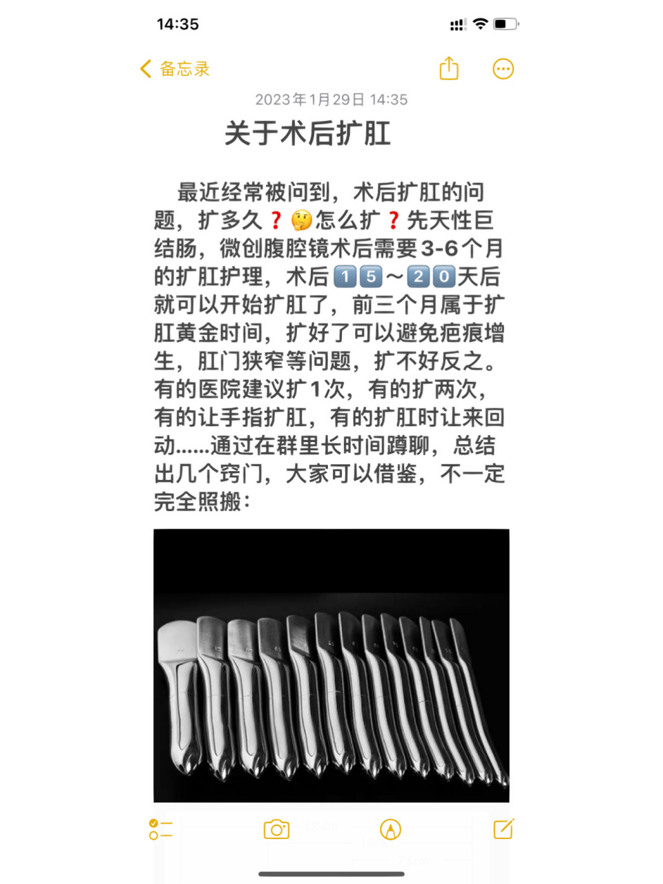 先天性巨结肠术后扩肛方法 最近经常被问到,术后扩肛的问题,扩多久