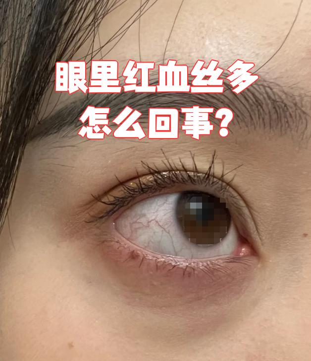 眼睛红是为什么
