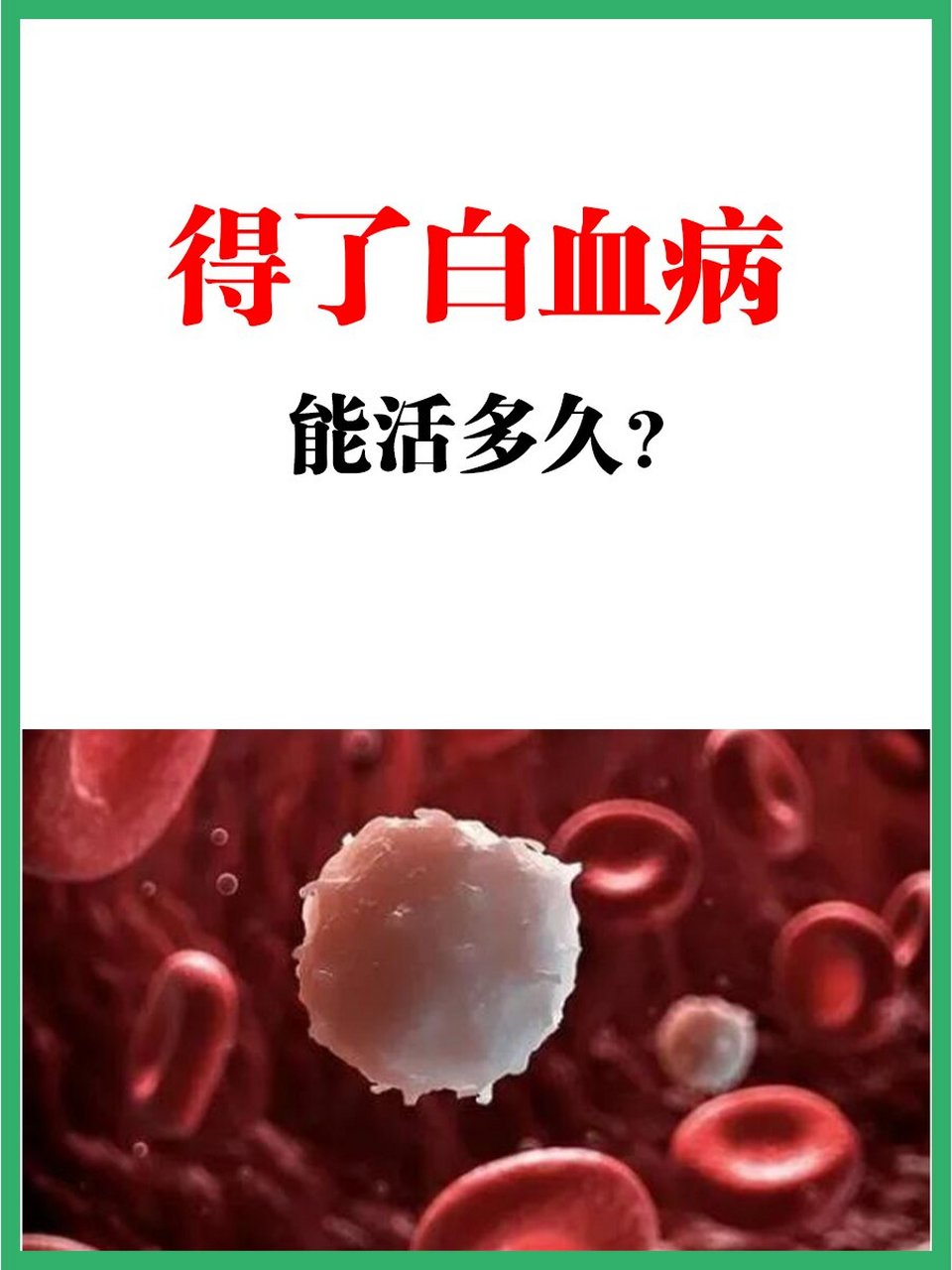 得了白血病,能活多久?
