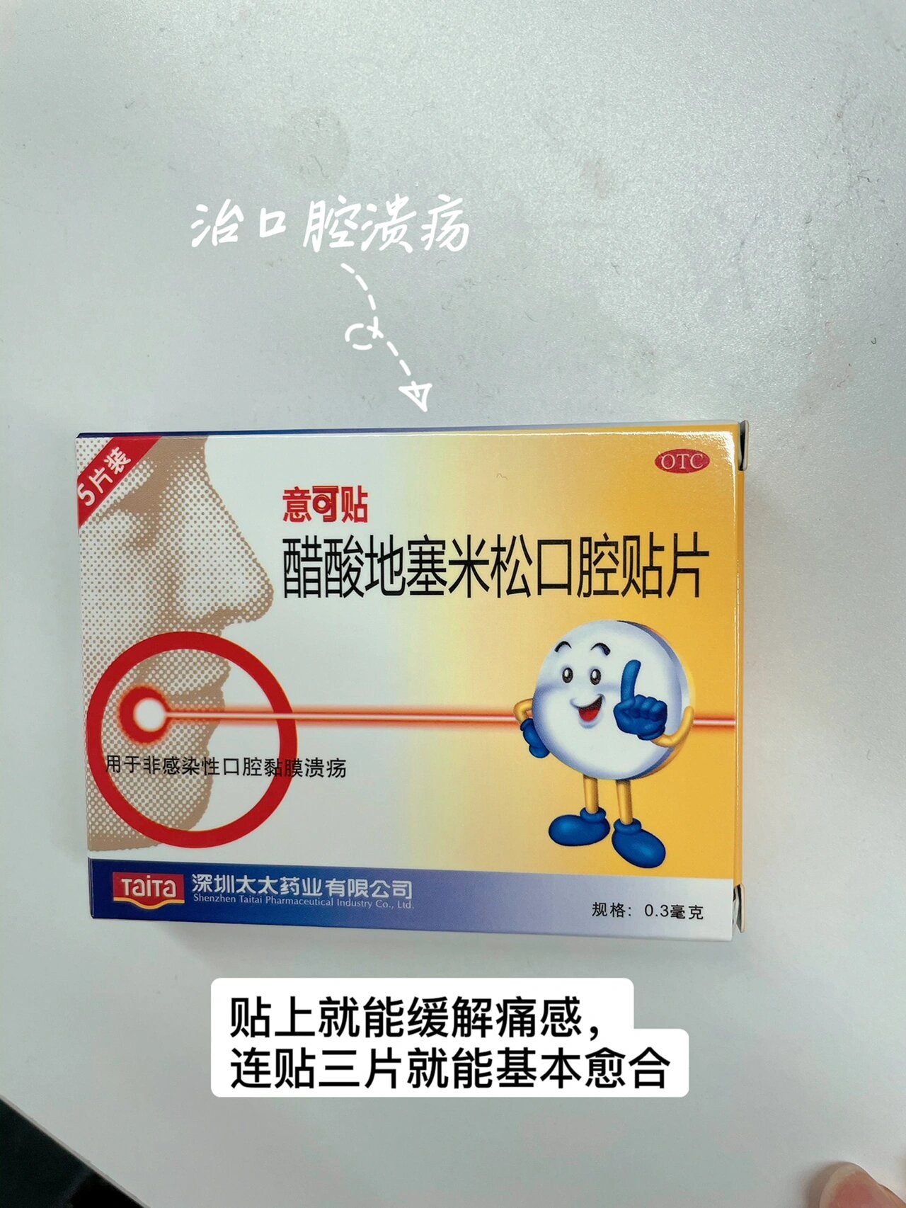 意可贴治口腔溃疡