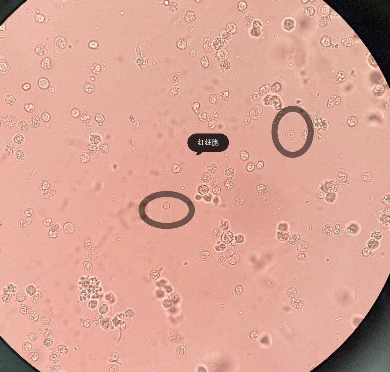 尿常规镜检图片图片