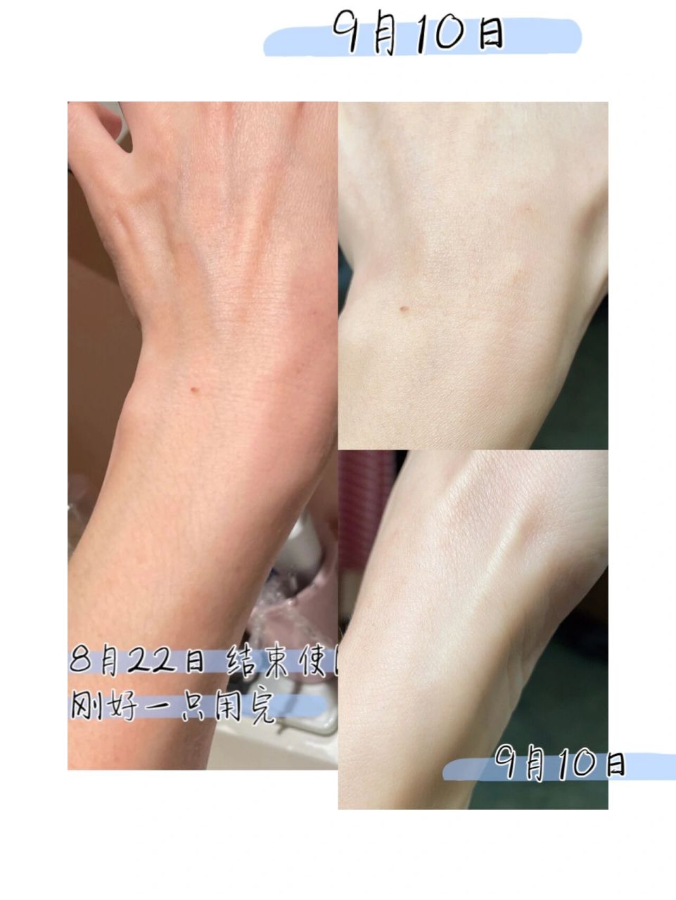 晒斑救星 无需代购 西双版纳回来 我的手上悲剧了 明显的晒斑 吓到我