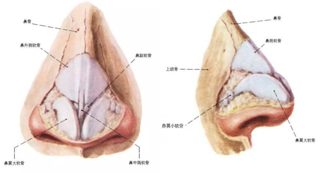 鼻软骨发育不良图片