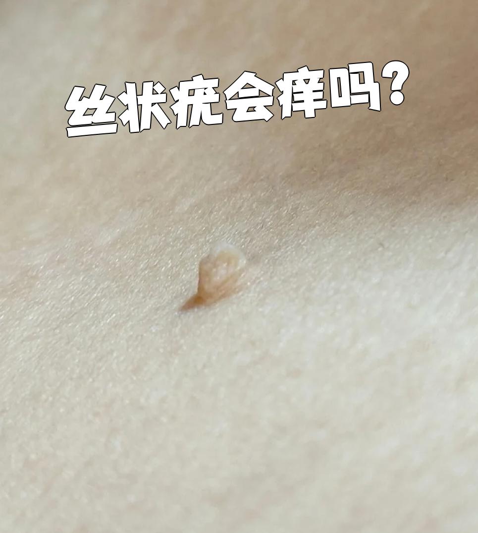 它通过直接或间接接触传染,看起来像细长的小肉条,很多时候能自己慢慢