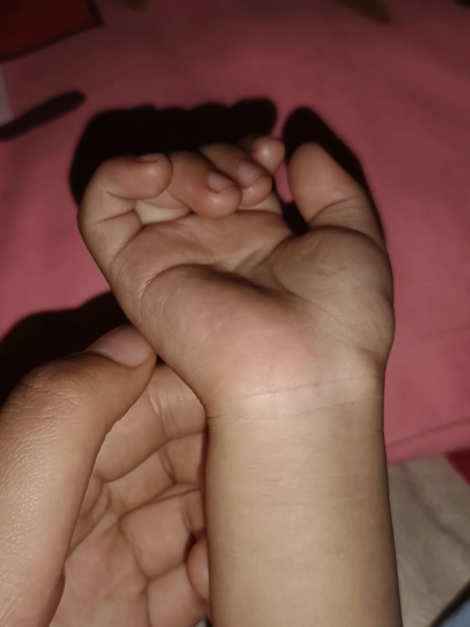 一岁三个月宝宝手腕上摸着像骨头的硬疙瘩 不疼不痒摸起来像骨头的硬