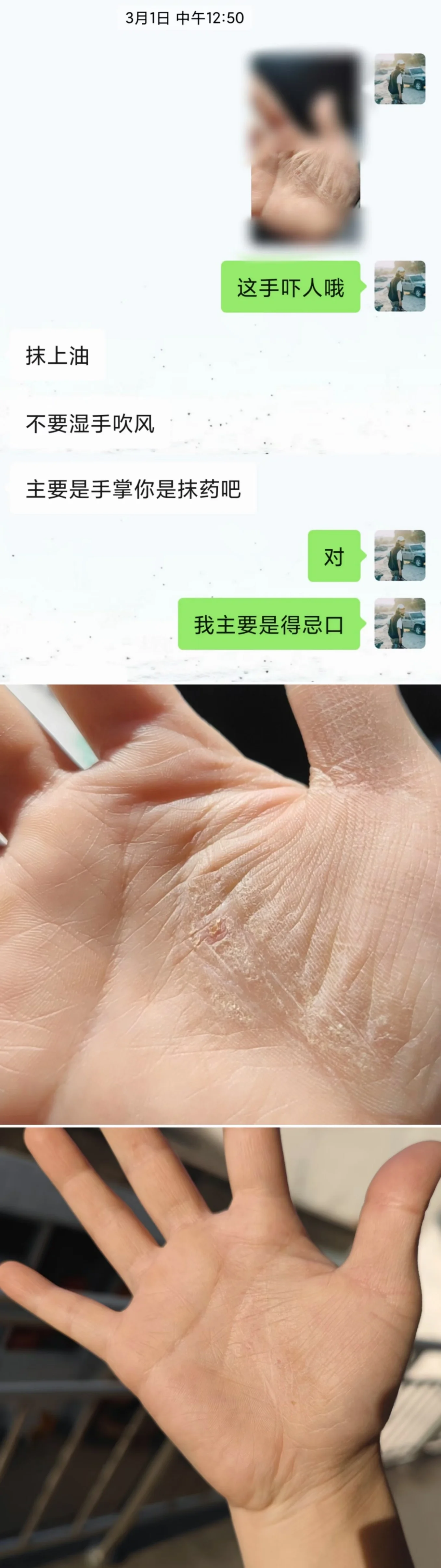 手心特别痒是什么情况!