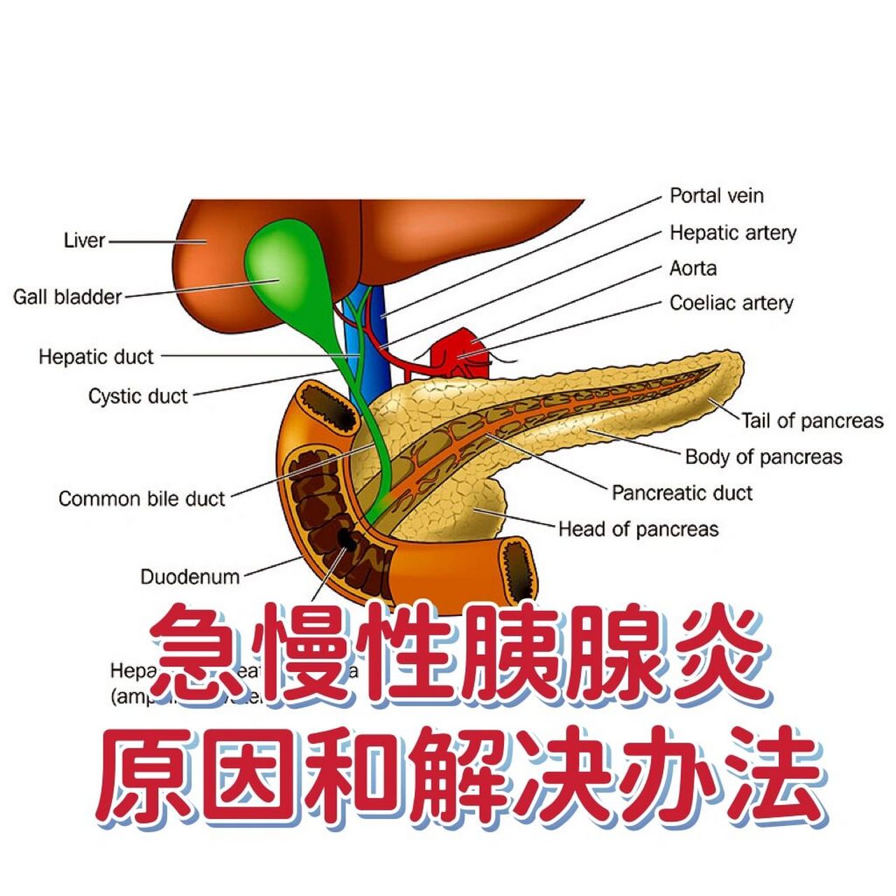 急慢性胰腺炎原因和解决办法 胰腺是一个小腺体,头端位于十二指肠弯曲