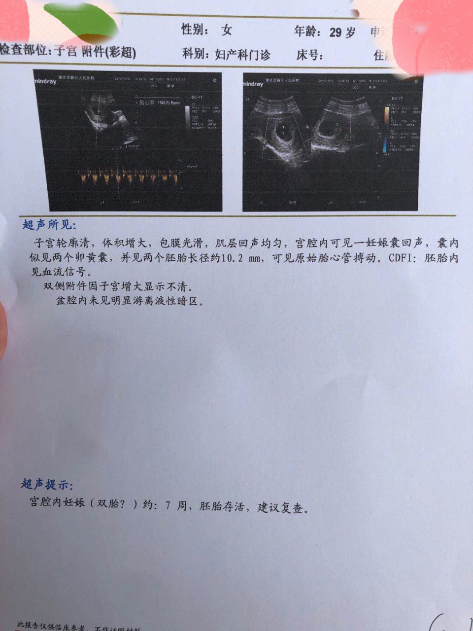 双胎孕早期分享 我们家宝宝是属于单绒双羊,因为是在没有备孕的情况下