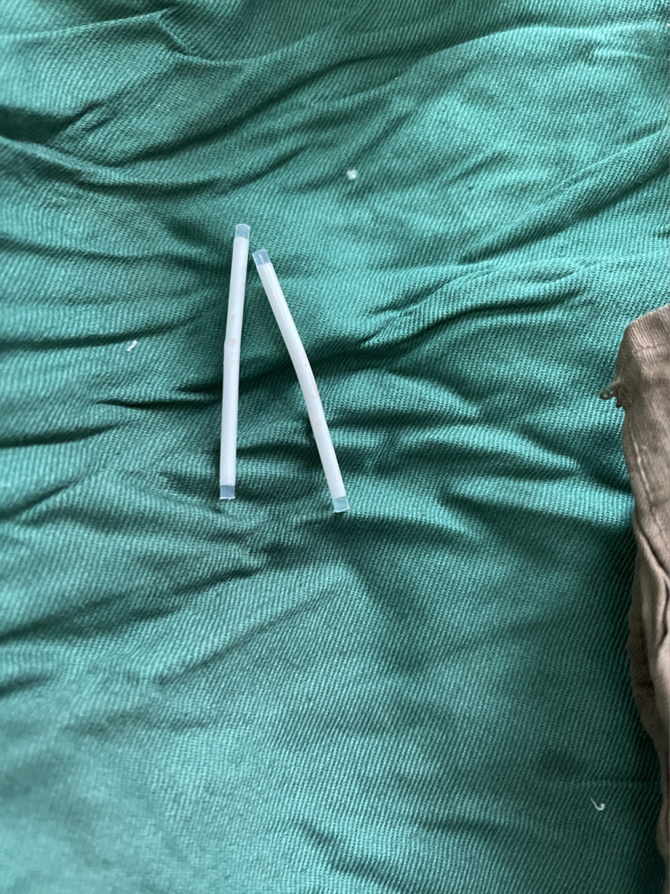 现在很多人都知道这种新型的避孕方式—皮下埋植术 它是通过把两根