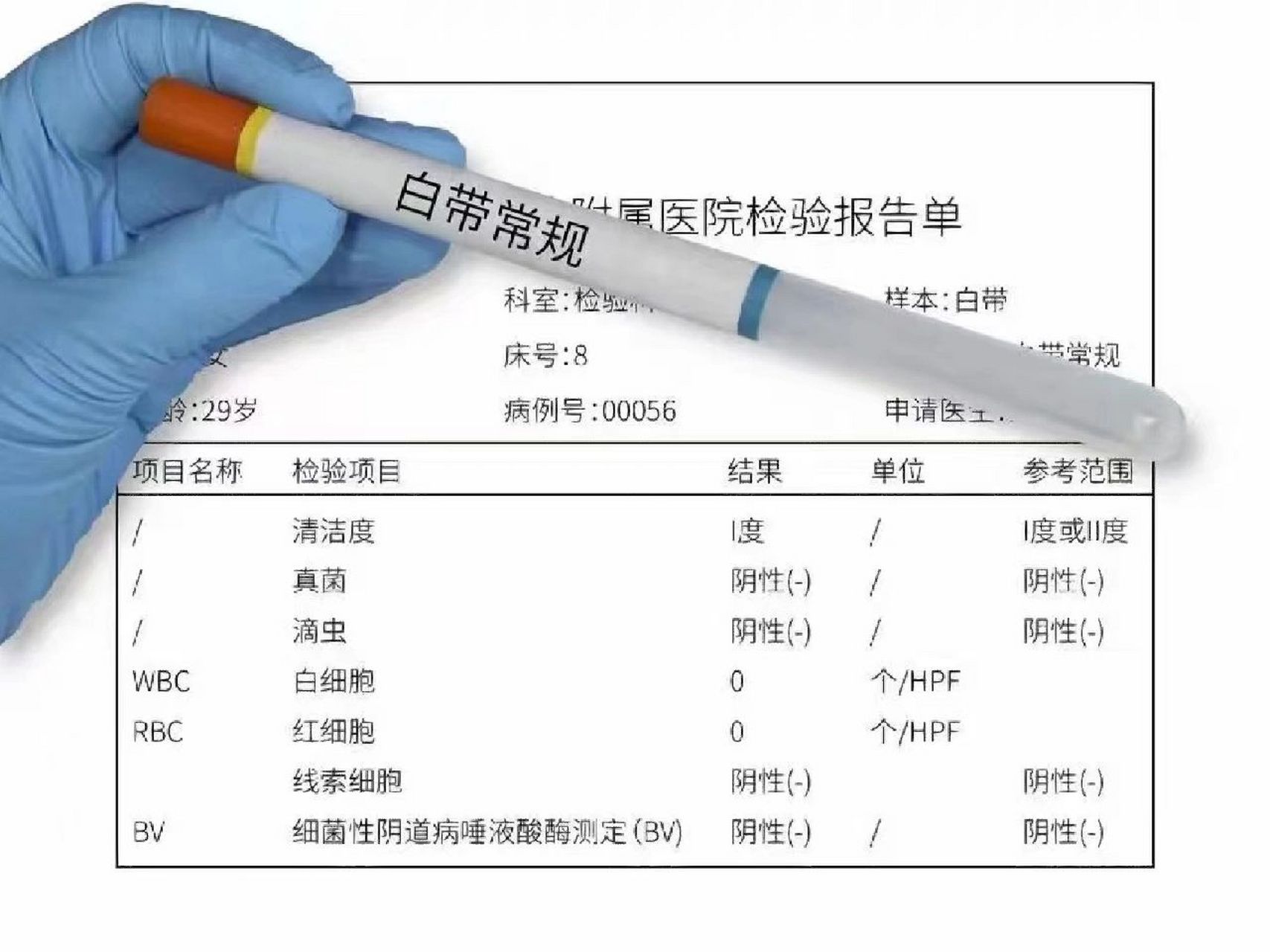 清洁度三度什么意思图片