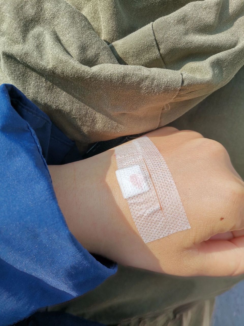 挂水挂的手都青了呜呜呜 前几天感冒了  去医院挂水 结果过几天再看看