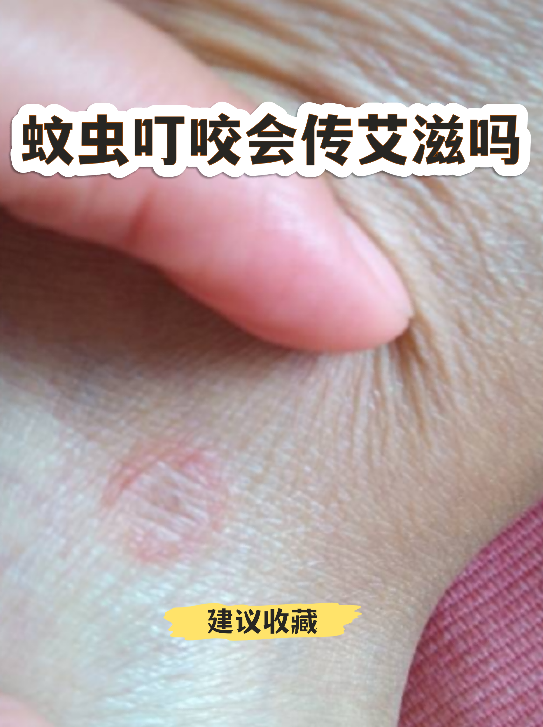  蚊子传新冠病毒吗?(蚊子传染新冠病毒是真的吗)
