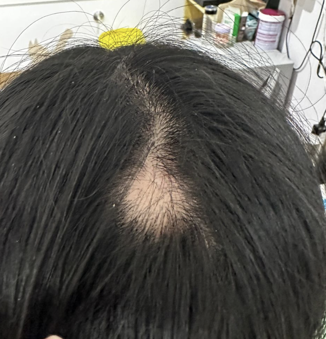 为什么头发很痒