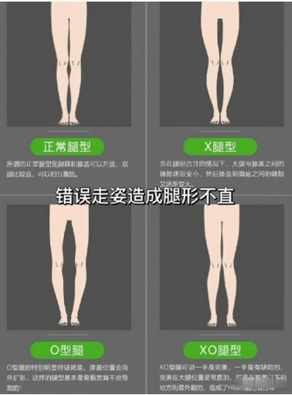 专家称臀部发力走路需因人而异# 【用臀部发力才是正确的走路姿势?