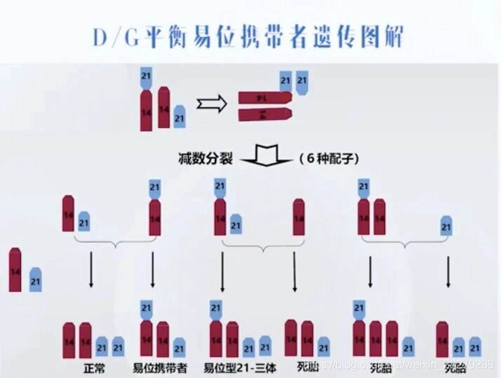 医学遗传学】罗伯逊易位&非同源染色体易位 97罗伯逊易位 d/g